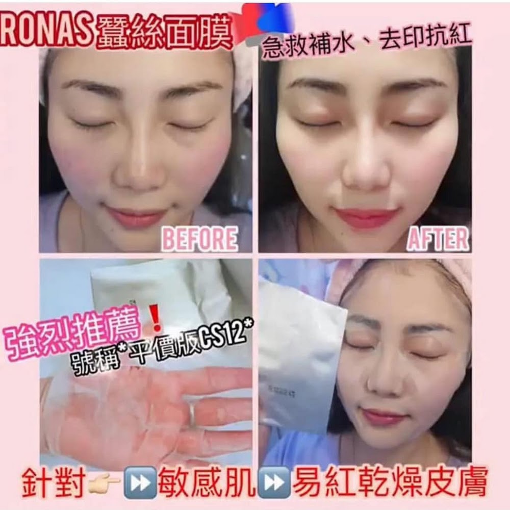 RONAS 銀色蠶絲面膜 Peptide Silk Mask