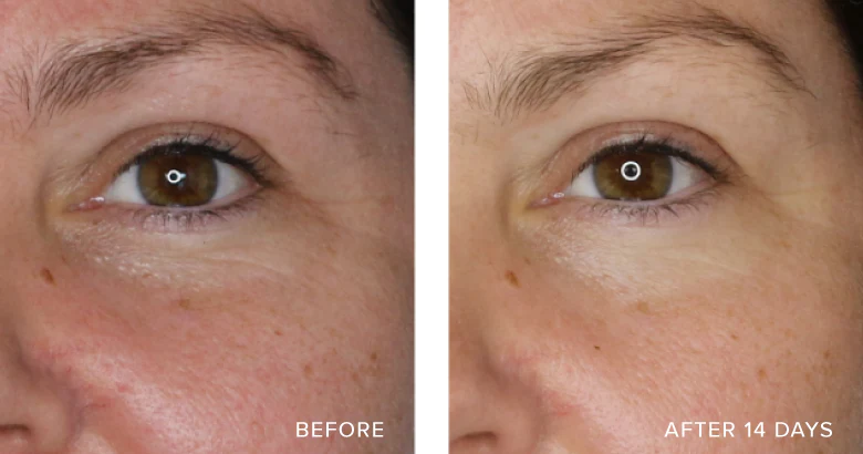 Retreatment Botanics Kadakdu Brightening Serum 卡卡杜李亮白精華液